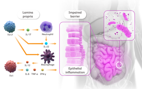 Torso with call-outs to gut microbiota on the right and IBD inflammatory cascade schematic on the left.