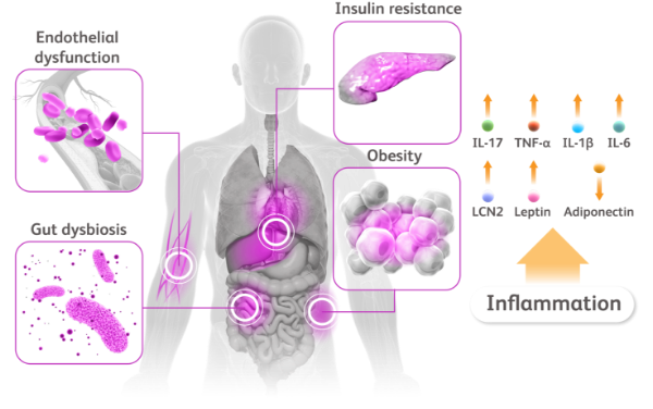 Torso with heart, blood cells, fat, pancreas, and gut microbiota call-outs on the left with upward arrows denoting inflammatory cytokines to the right.