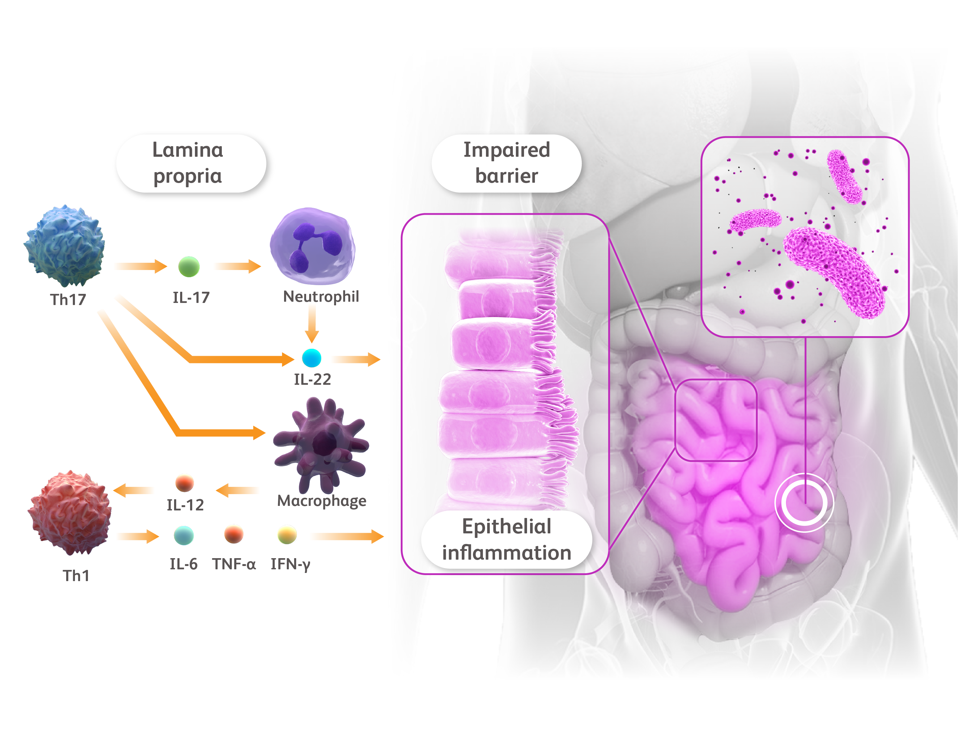 Torso with call-outs to gut microbiota on the right and IBD inflammatory cascade schematic on the left.