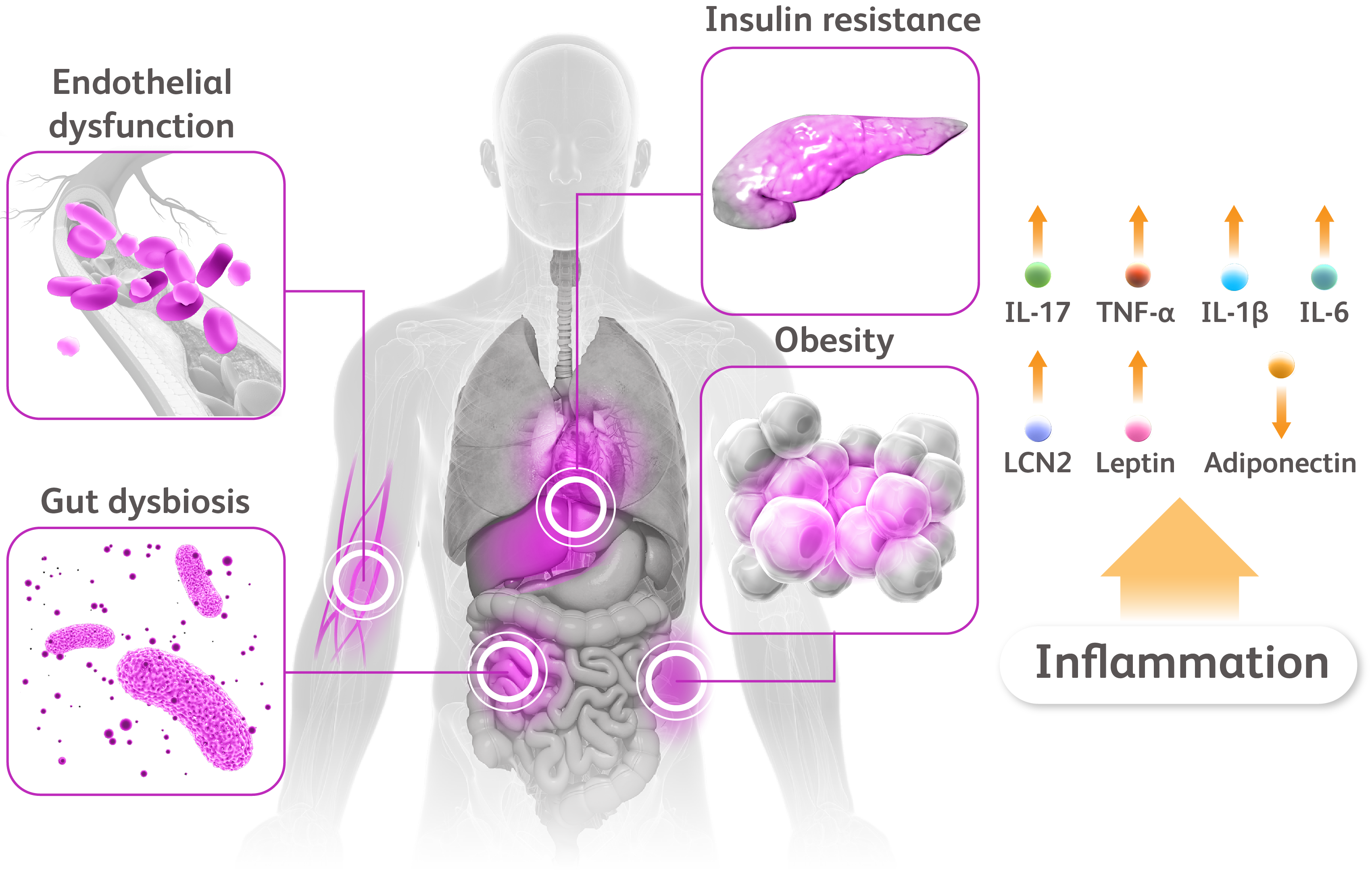 Torso with heart, blood cells, fat, pancreas, and gut microbiota call-outs on the left with upward arrows denoting inflammatory cytokines to the right.