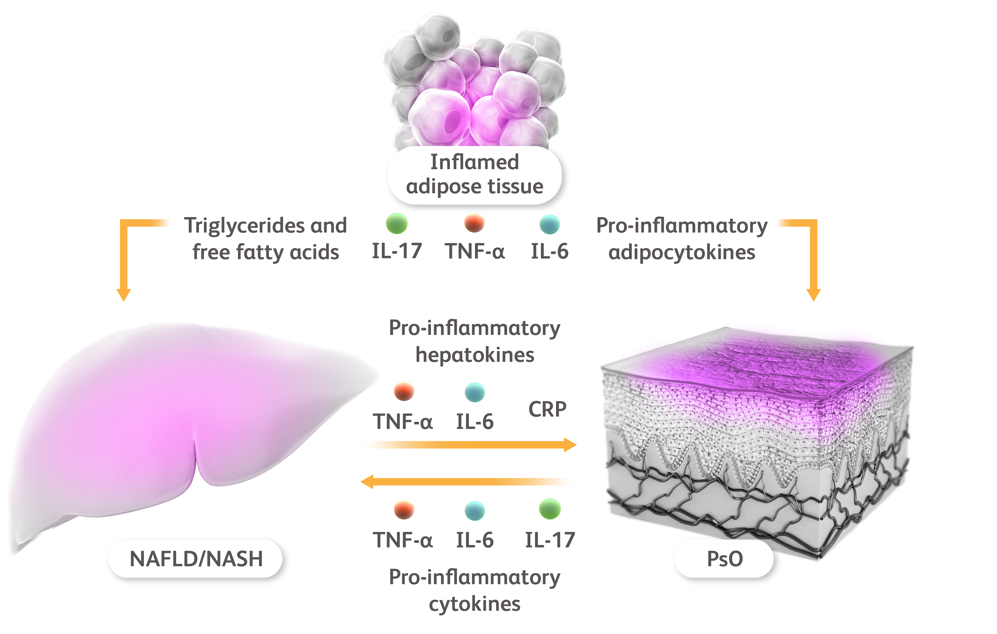 Schematic showing inflammatory cytokines that may link the liver with adipose tissue and psoriasis.