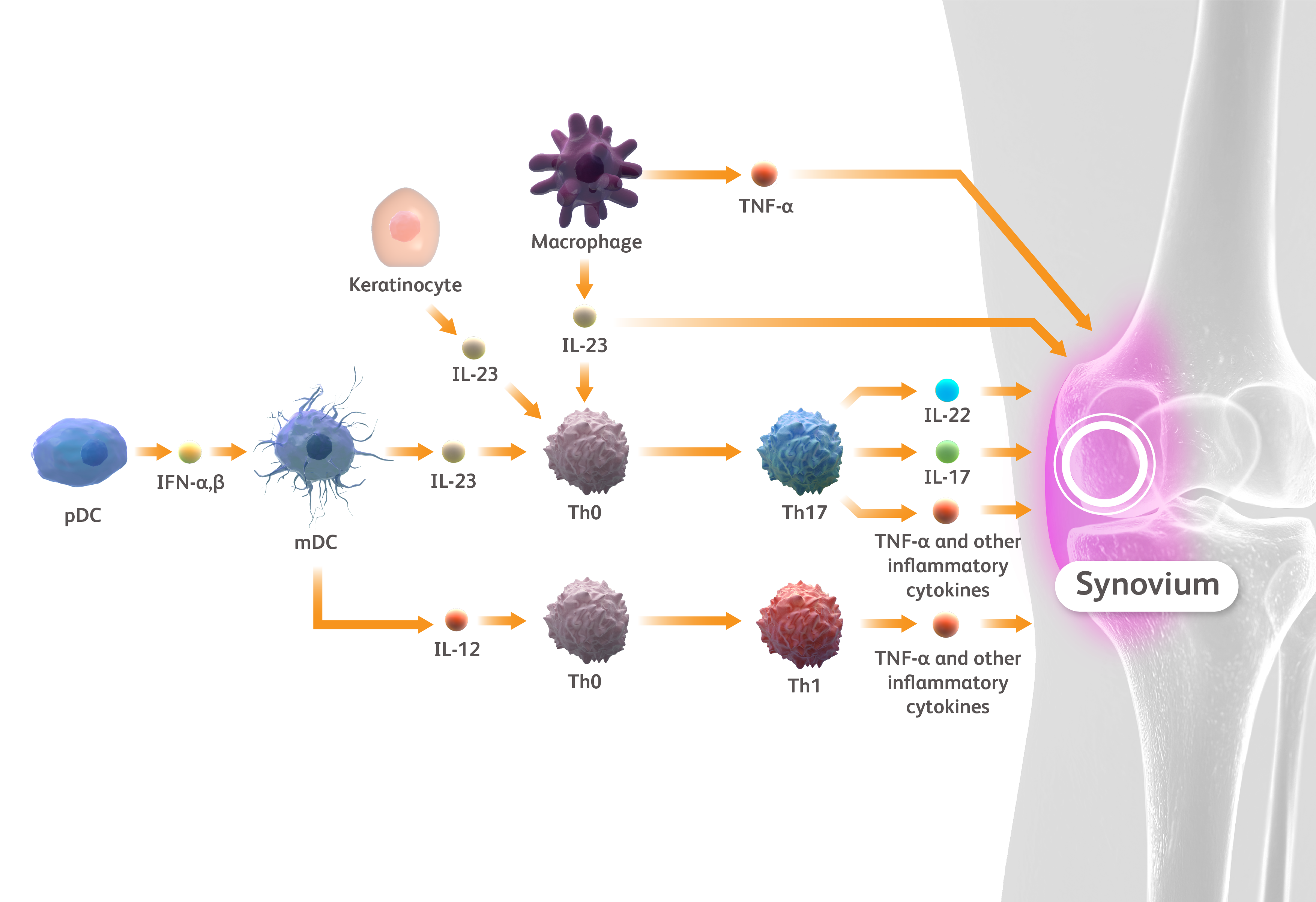 Synovium on the right, and key inflammatory cells and cytokines in PsA on the left.